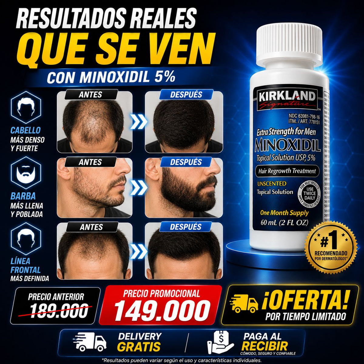 Minoxidil Kirkland Original al 5%