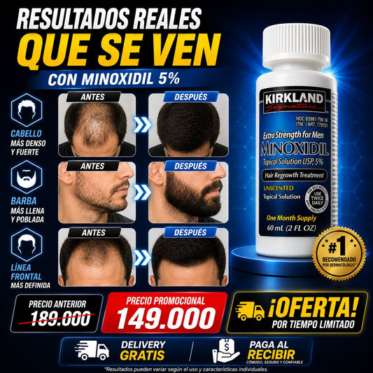 Minoxidil Kirkland Original al 5%